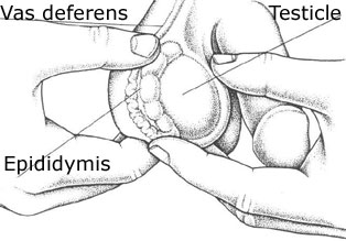 Resultado de imagen para mitos de dolor en los testiculos