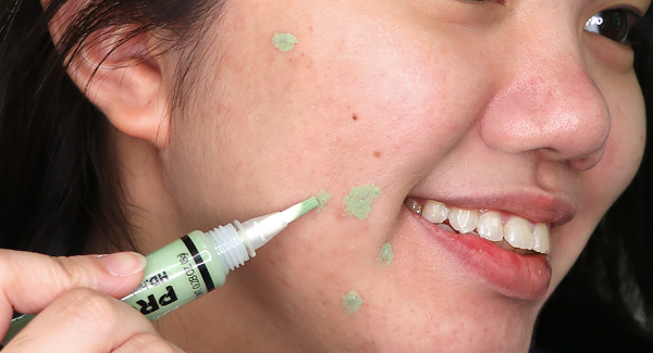 colour corrector for acne scars