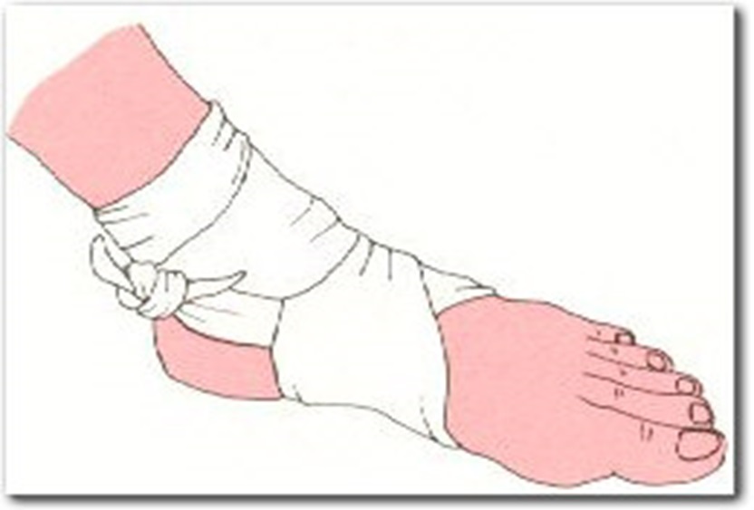 PROTOCOLO DE PRIMEROS AUXILIOS "VENDAJES" VENDAJE PARA PIE