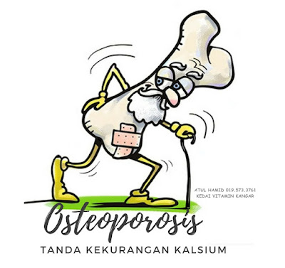 30 TANDA-TANDA KEKURANGAN KALSIUM