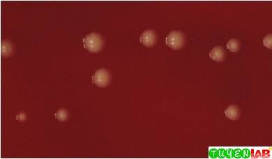 Example of the yellow colonies characteristic of certain nonpathogenic species of Neisseria organisms on blood agar. Example of the yellow colonies characteristic of certain nonpathogenic species of Neisseria organisms on blood agar.