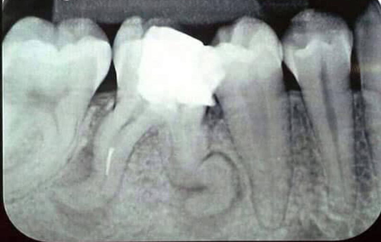 The Endo Blog Is Your Endodontist A Partner in Patient Care?