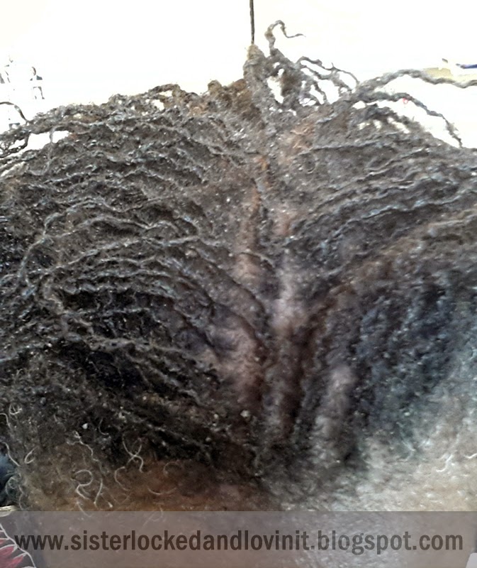 Sisterlocked Diva New sisterlocks and dry scalp