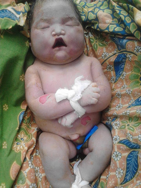 Kisah Memilukan Ibu Yang Melahirkan Bayi Meninggal Dalam Kandungan Kisah Memilukan Ibu Yang Melahirkan Bayi Meninggal Dalam Kandungan
