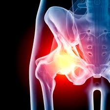 Affordable Hip replacement surgery in India