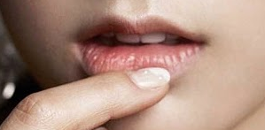 6 Penyebab Bibir Kering dan Pecah-Pecah 6 Penyebab Bibir Kering dan Pecah-Pecah