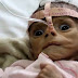 Media Silent As Saudi Arabia Devastates Yemen Into Famine