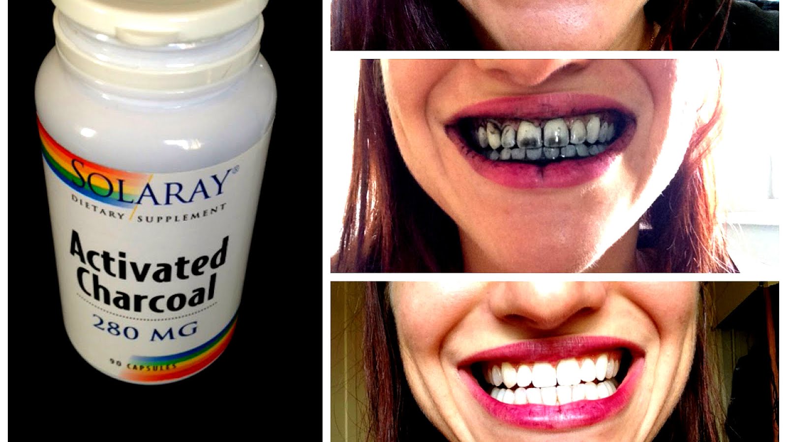 Does Charcoal Whiten Teeth White Choices