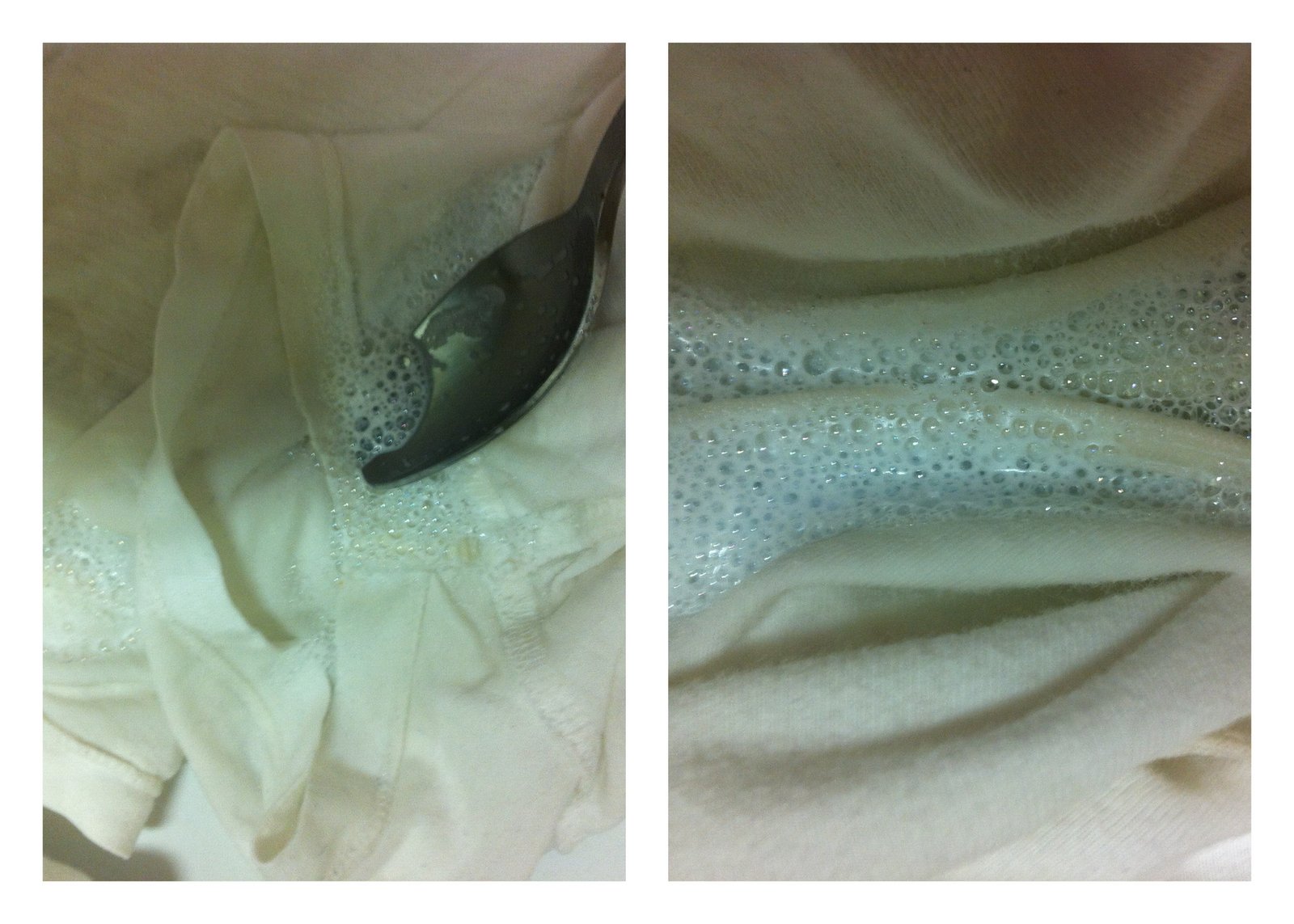 Perfect Tips About How To Get Rid Of Armpit Cleavage Postmary11