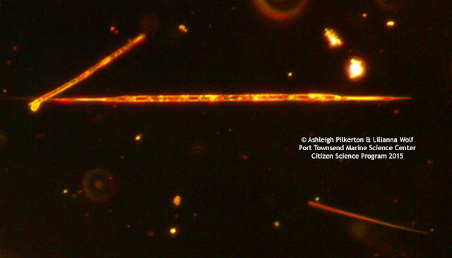 Microscopy image of algae Pseudo-nitzschia.