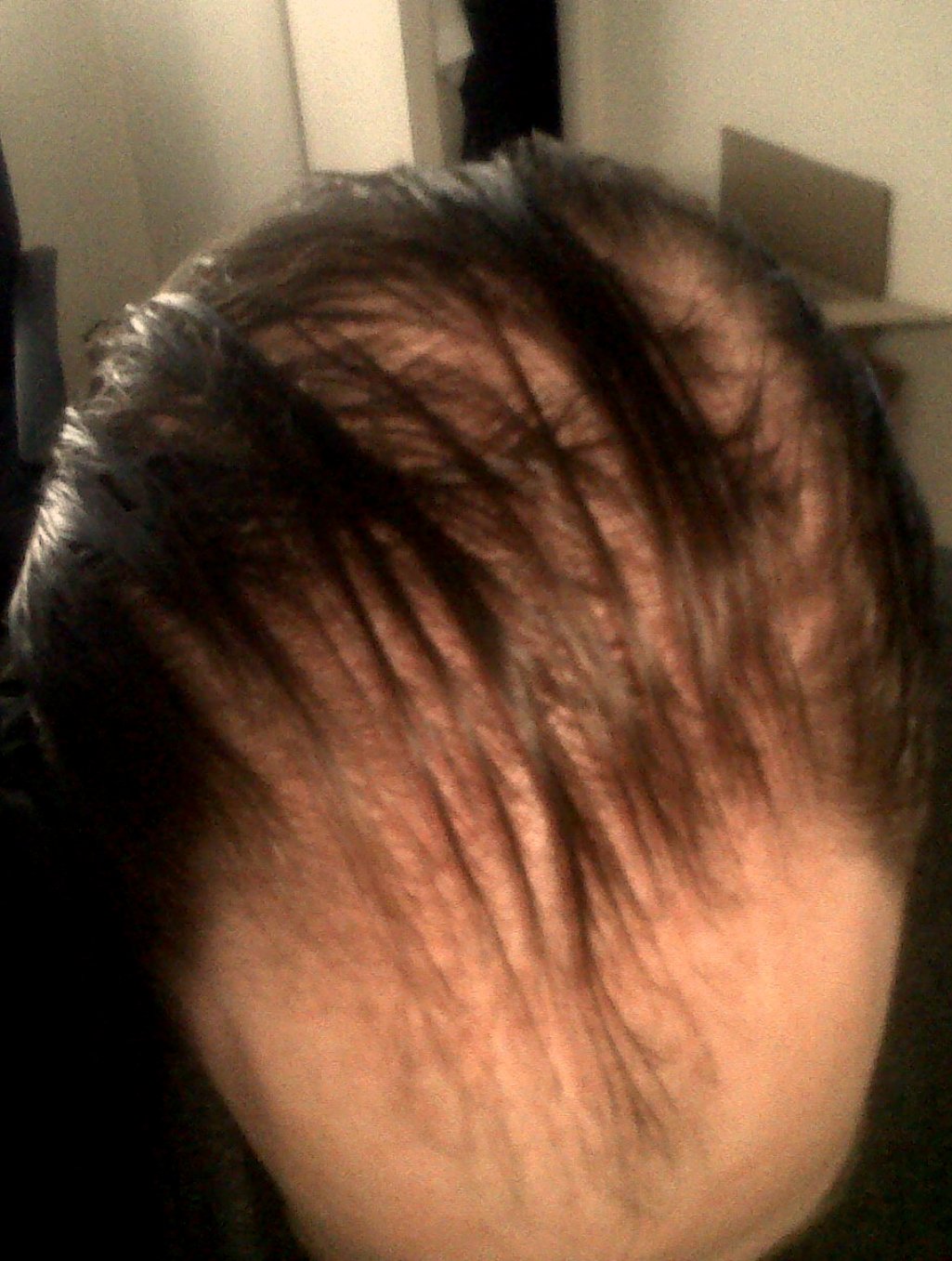 MUNGKOPAS Dampak pada Tatanan Rambut