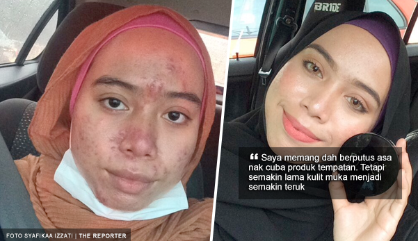 kesan buruk brilliant skincare