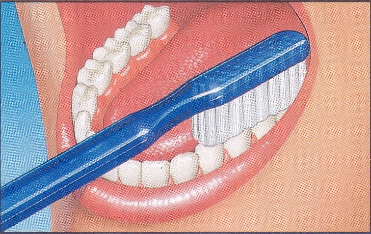 Cuidado Dental TÉcnica Del Cepillado