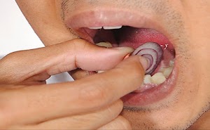 Comment traiter naturellement le mal de dents et l’infection dentaire?