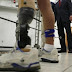 Ερευνητής σχεδίασε ένα ιδιαίτερα φθηνό βιονικό πόδι