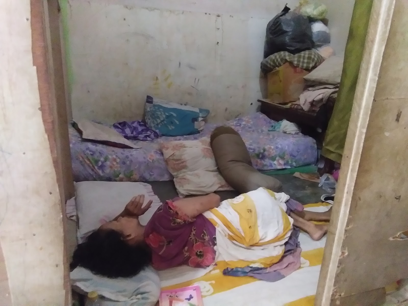 Korban yang menderita penyakit gatal-gatal di Asahan dan mengalami pengecilan kaki. Korban yang menderita penyakit gatal-gatal di Asahan dan mengalami pengecilan kaki.
