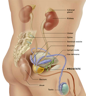 Clinica urologica prostatita Cancer renal sintomatologia, Cancer de prostata en edad joven