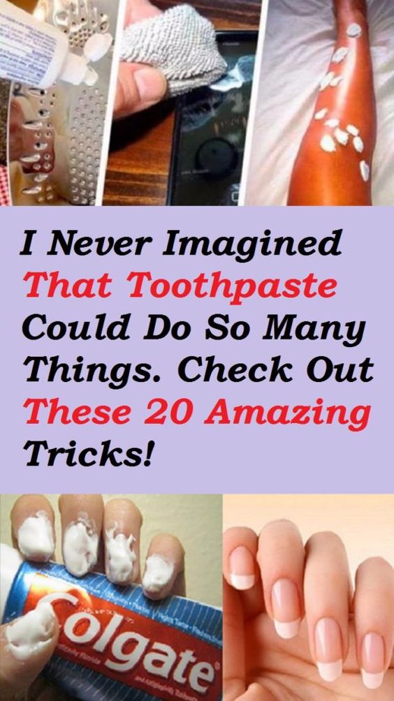 I Never Imagined That Toothpaste Could Do So Many Things. Check Out