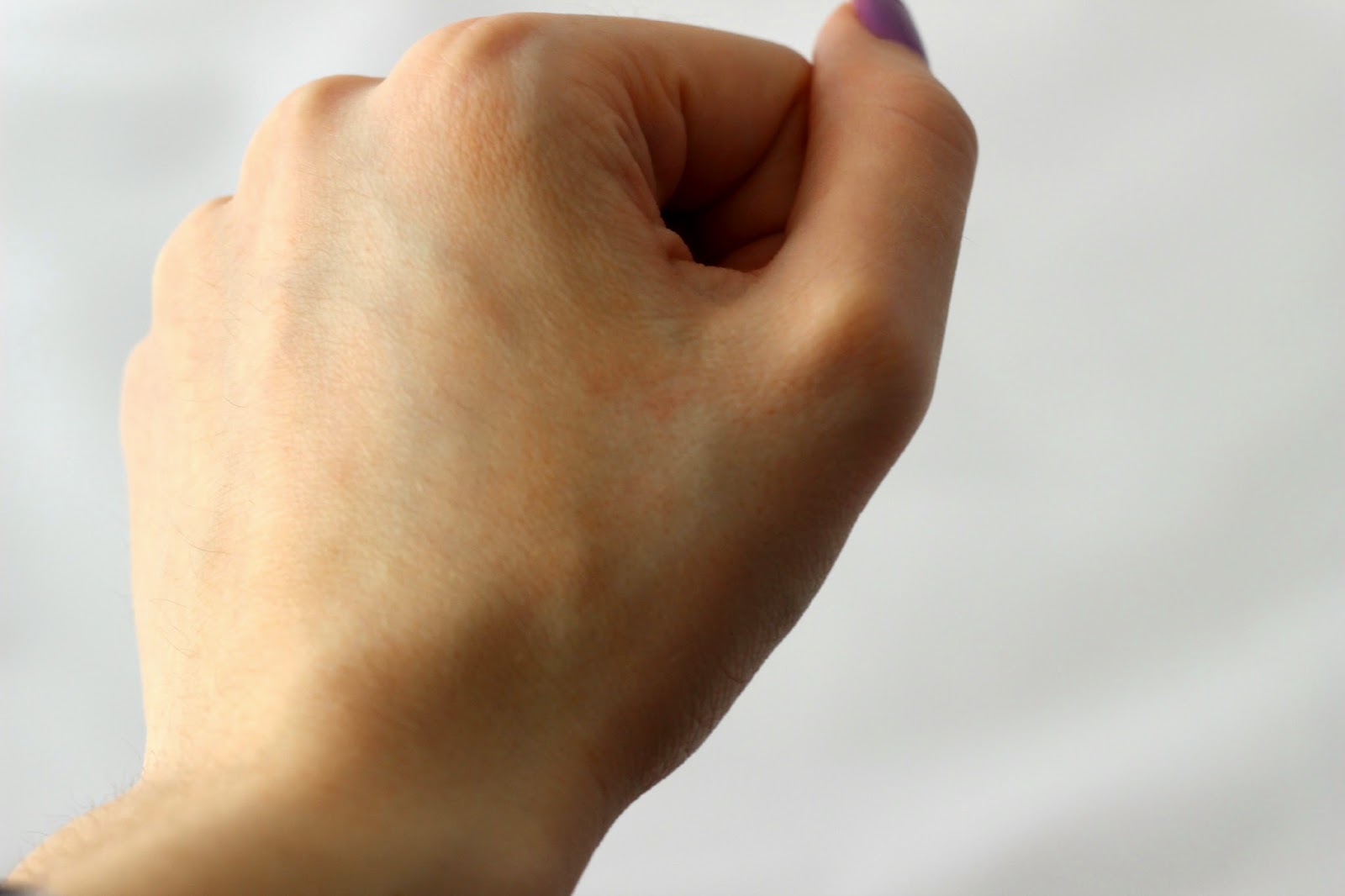 Margarite Zinc Cream for Problem Skin Effective Spot Treatment