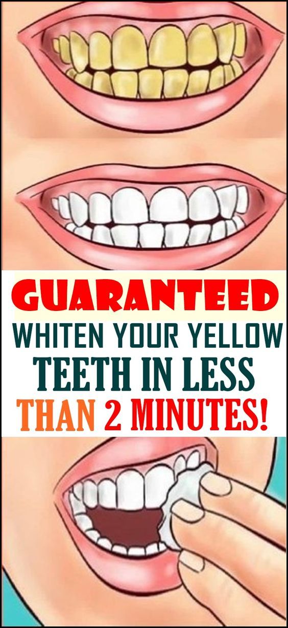 How to Whiten Your Teeth At Home In 2 Minutes Home Remedy Posts