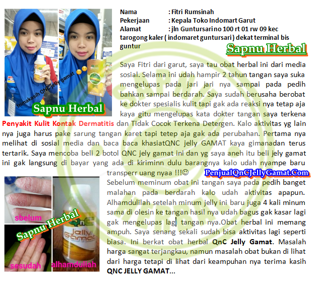 Cara Menyembuhkan Gatal Pada Kulit yang Tidak Kunjung Sembuh Sampai Tuntas Cara Menyembuhkan Gatal Pada Kulit yang Tidak Kunjung Sembuh Sampai Tuntas