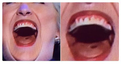 hillary neck 2