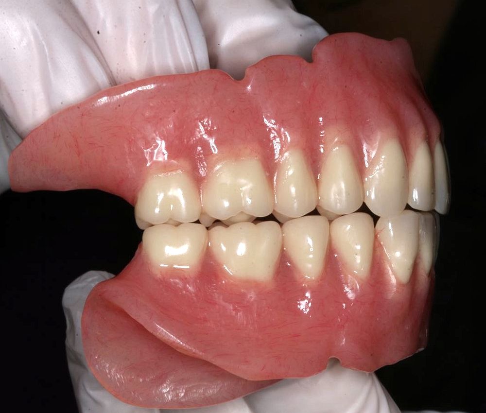 DENTAL PROSTHESES The retention of complete dentures Directorio
