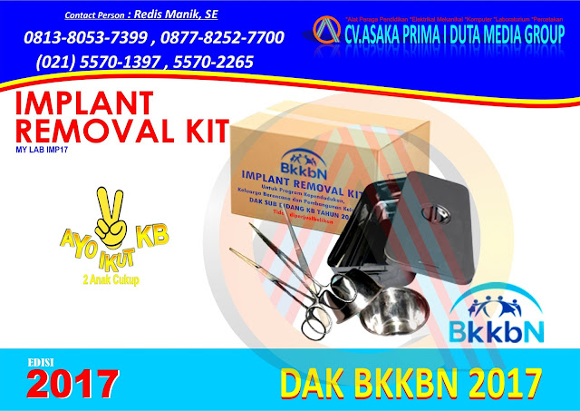 implant removal kit 2017,Implant Kit 2017 ,ImplanT ReMoval Kit 2017 ,jual Implant Kit 2017,jual Implant removel kit 2017,implant 2017,implant kit murah 2017,implant rEmoval Kit murah 2017,rab Implant Kit 2017,implant kit bkkbn 2017 implant removal kit 2017,Implant Kit 2017 ,ImplanT ReMoval Kit 2017 ,jual Implant Kit 2017,jual Implant removel kit 2017,implant 2017,implant kit murah 2017,implant rEmoval Kit murah 2017,rab Implant Kit 2017,implant kit bkkbn 2017