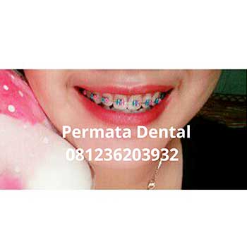 Gambar Behel Gigi Fashion