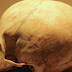 Дупка в черепа. Впечатляващите постижения на инките в черепните операции