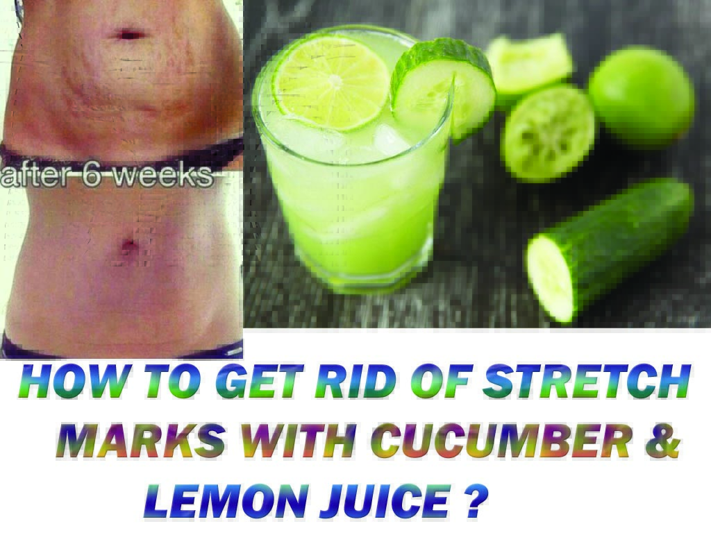 HOW TO GET RID OF STRETCH MARKS FAST AND NATURALLY OVERNIGHT AT HOME