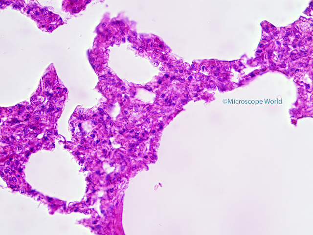 Image of lungs under the microscope at 400x captured by Microscope World.