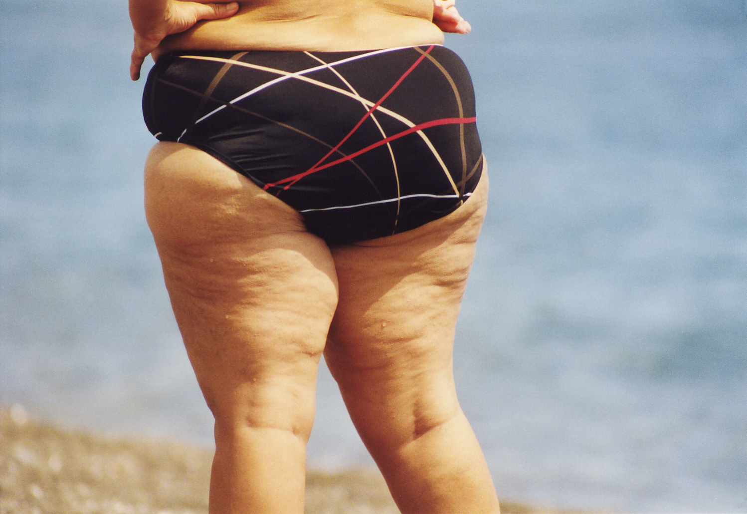 Amazon rouleau cellulite Amazon rouleau cellulite