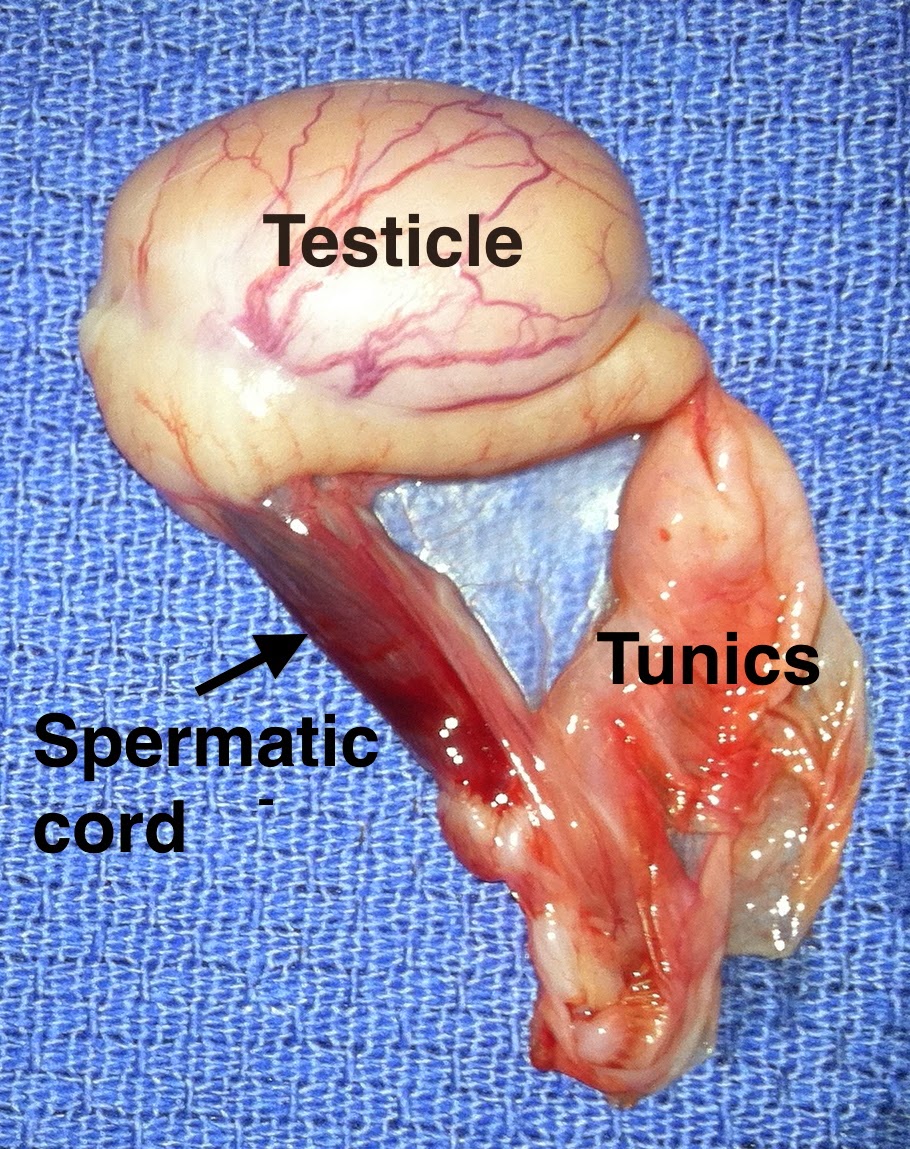 5: Closed castration allows removal of the parietal vaginal tunic with the testicle...