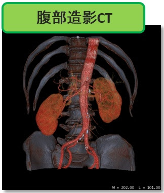 『CT検査』検査の概要とながれについて解説