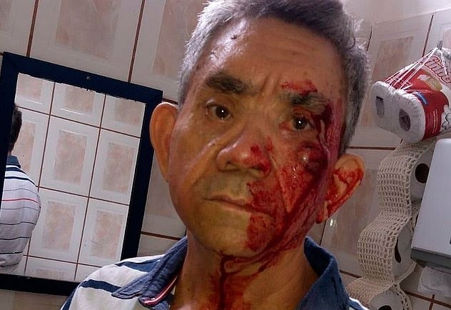 ‘Não quero mais dar aulas’, diz professor agredido por aluno de 14 anos