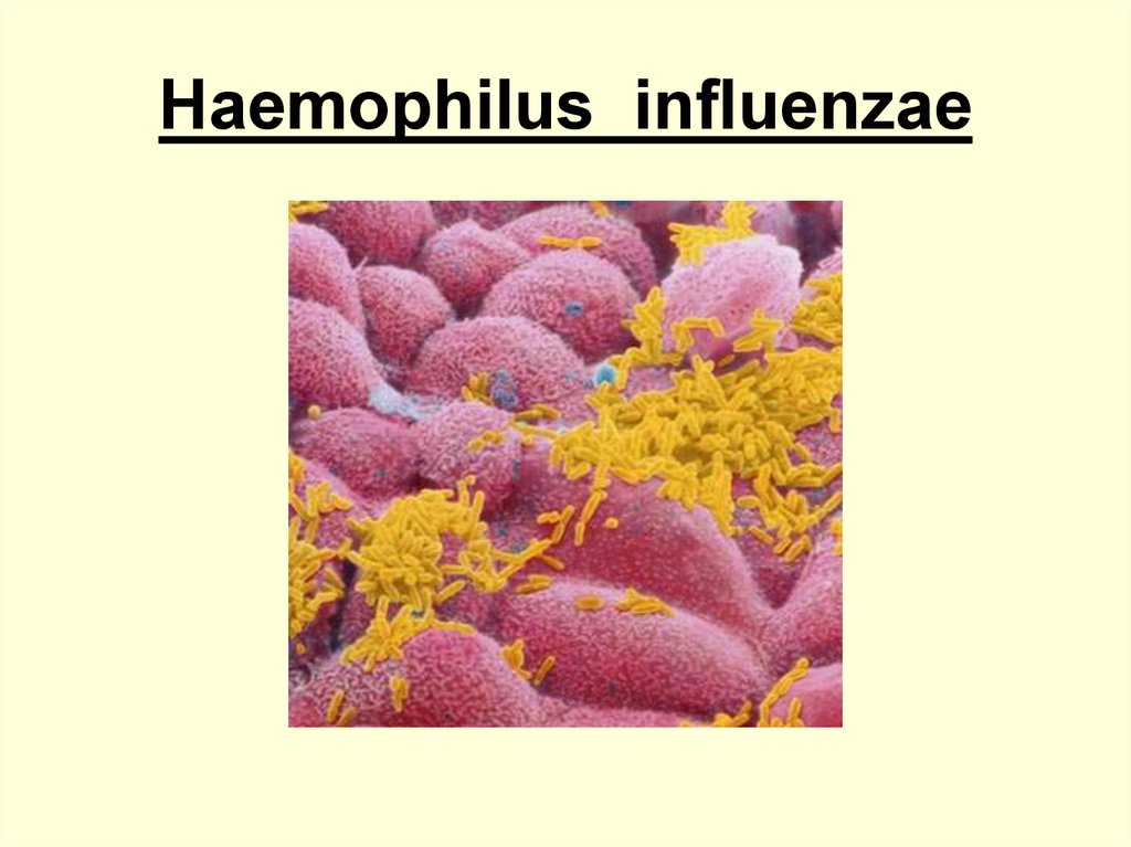 Haemophilus influenzae Characteristics, Habitat , Pathogenicity