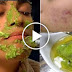 Want A Fairer And Healthier Facial Skin Without Spending Money? Try This Amazing Avocado Mask