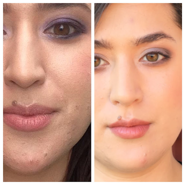 Faceonomics How I Fixed My Dehydrated Skin