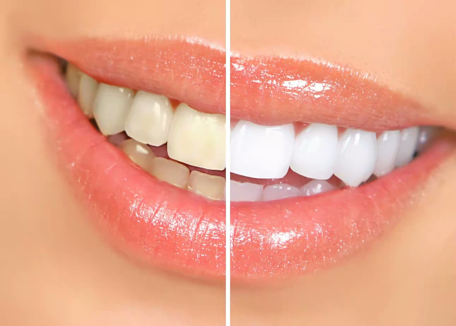 How to maintain a healthy and clean white teeth