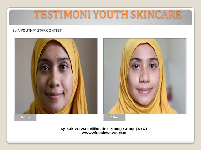 34 Testimoni Youth Skincare Shaklee Terbaru, Youth skincare shaklee, testimoni youth skincare shaklee, Youth Skincare Shaklee : Harga dan Review Pengguna Youth Shaklee, testimoni youth skincare shaklee, testimoni youth skincare shaklee 34 Testimoni Youth Skincare Shaklee Terbaru, Youth skincare shaklee, testimoni youth skincare shaklee, Youth Skincare Shaklee : Harga dan Review Pengguna Youth Shaklee, testimoni youth skincare shaklee, testimoni youth skincare shaklee