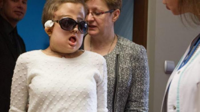 3 Tahun Jalani Operasi Transplantasi, Wajah Wanita Ini Sukses dirubah Jadi Lebih Jelas Setelah Hancur Terserah Tumor 3 Tahun Jalani Operasi Transplantasi, Wajah Wanita Ini Sukses dirubah Jadi Lebih Jelas Setelah Hancur Terserah Tumor