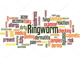 ringworm-www.healthnote25.com