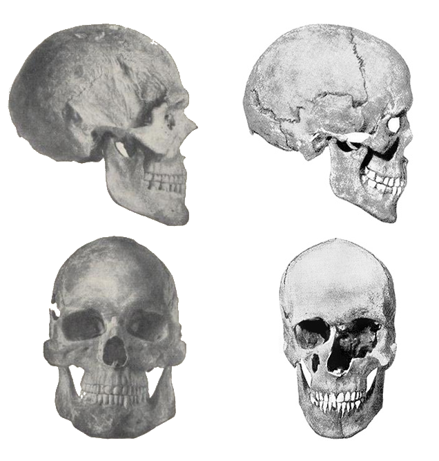 Варианты формы черепа. Форма черепа. Форма человеческого черепа. Правильная форма черепа. Типы черепов человека.