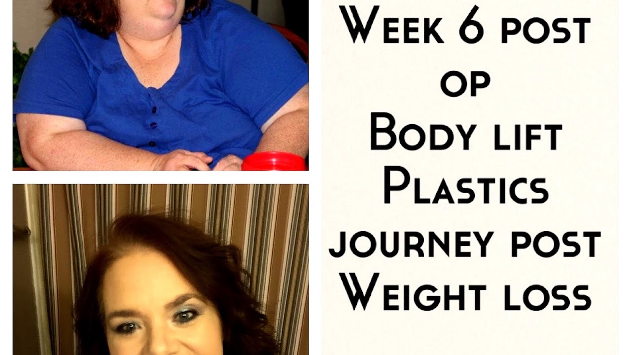 360 Body Lift Cost Lift Choices