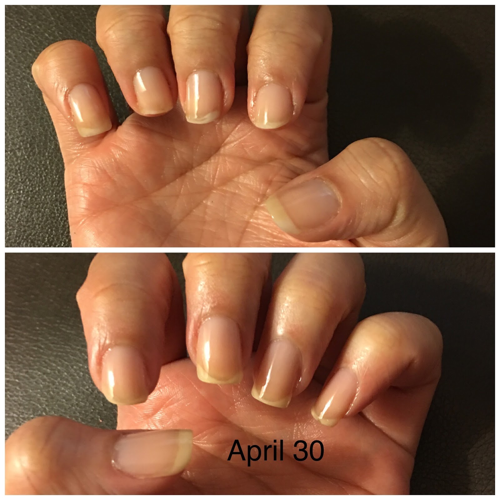 How to Save and Regrow Nails After a Break