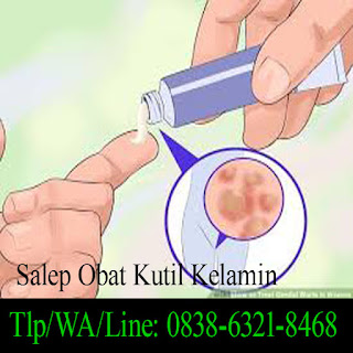 Obat Kutil Kelamin