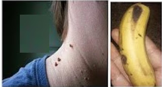 استخدامات مذهلة جدا لقشور الموز ! لن ترميها بعد الان استخدامات مذهلة جدا لقشور الموز ! لن ترميها بعد الان