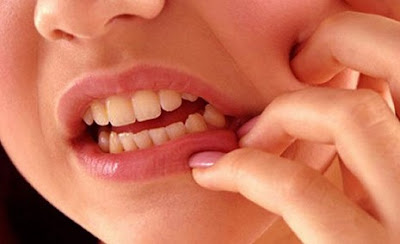 10 Makanan dan Minuman Yang Mudah Merusak Gigi