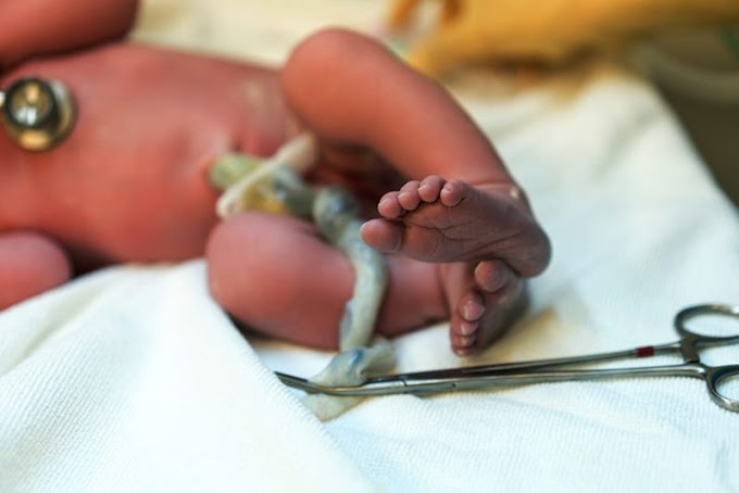 Bebeğin göbek kordonunun geç kesilmesi için 6 neden